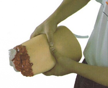 Analysis of lower limb trauma hemostasis model