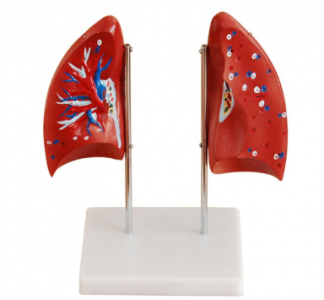 Pulmonary anatomical model: a valuable teaching resource in the medical field