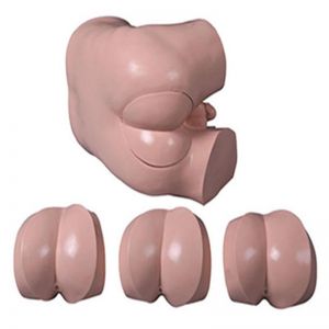 What are the core functional features of the rectal examination operating model?