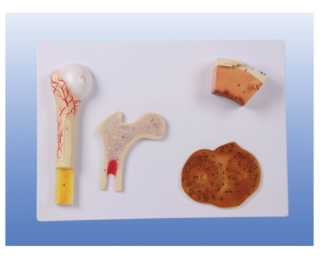 What is the application of enlarged bone structure model in medical education?