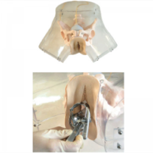  The versatility of the transparent curettage model provides a guarantee to meet diverse needs