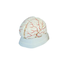 How does the cerebral artery model connect anatomy to clinical practice