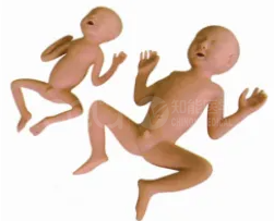 A 30-week preterm infant model