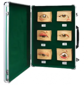 Common eye disease models