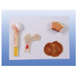 Bone structure magnification model