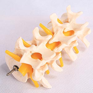 bone model