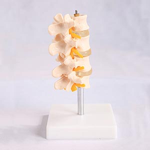 Lumbar assembly model
